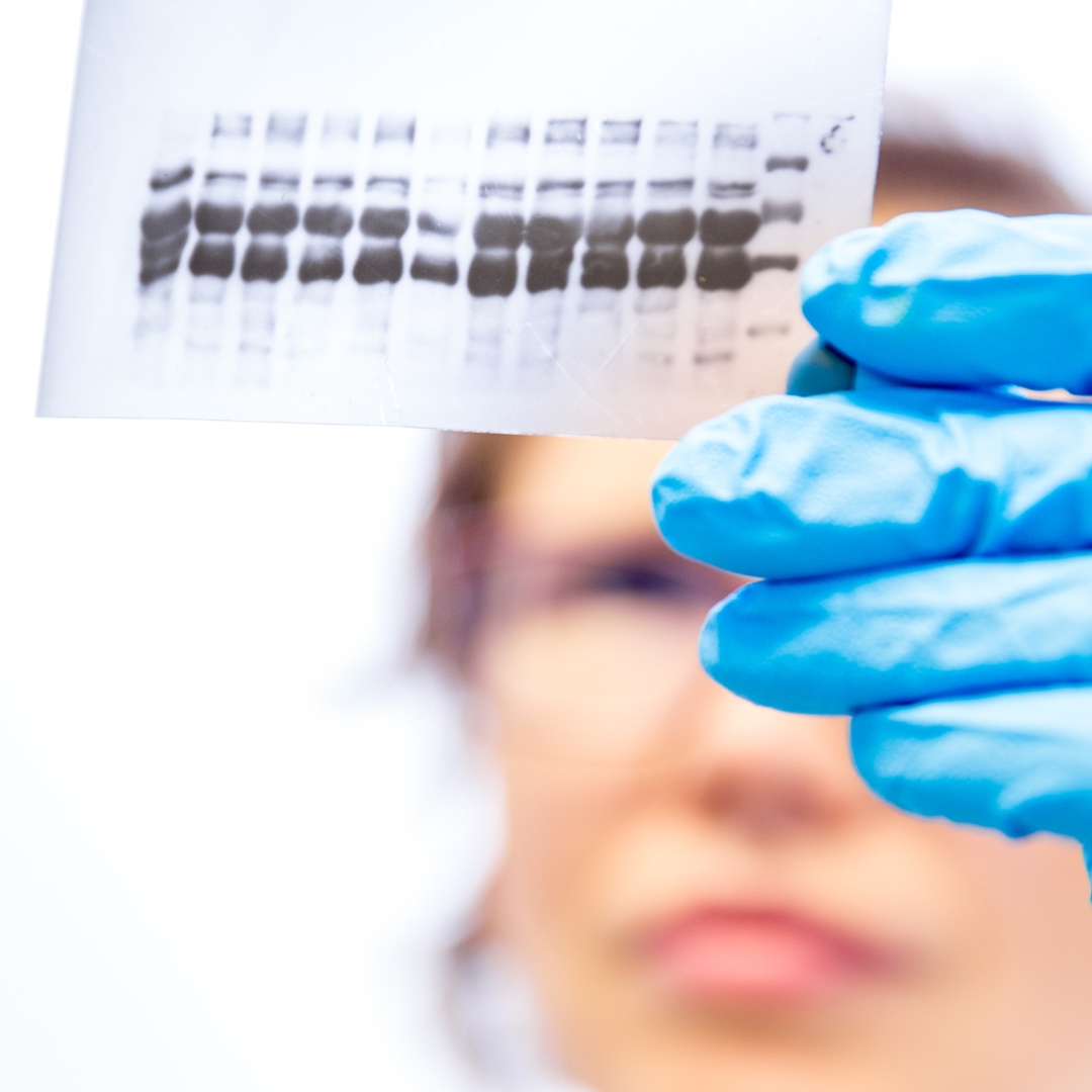 Lyme Disease Diagnosis & Treatment In Lawrenceville, NJ Princeton Lyme Disease Diagnosis & Treatment In Lawrenceville, NJ Princeton